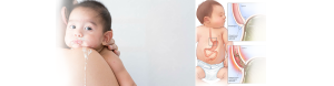 ASPECTOS QUIRÚRGICOS DEL NIÑO VOMITADOR